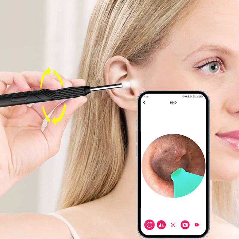 Cuffie In Ear Kit Per Rimozione Cerume Con Telecamera Ultra HD - Strumento Per Pulizia Orecchie, Sicuro E Riusabile Kit Pulizia Orecchie Portatile - Foto 8
